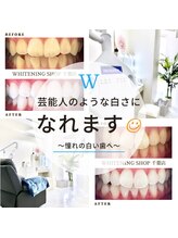 ホワイトニングショップ 千葉店/歯科提携　ホワイトニング専門店