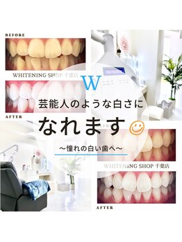 ホワイトニングショップ 千葉店/歯科提携　ホワイトニング専門店