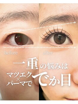 アッピーラッシュ 小倉店(Appy.Lash)/目幅2倍！マツエク×マツパ