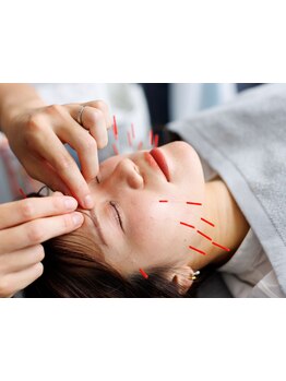 小顔になりたい