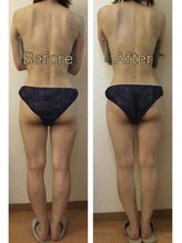 ズーサロン(zu_salon)/1回での変化