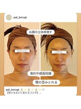 パル コルギサロン(Pal. Korugi salon)/コルギビフォーアフター