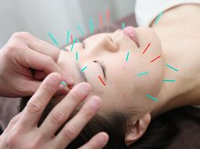 美容鍼/小顔/ヘッドスパ
