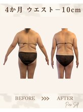 ピュアセルフ 新浦安(Pure Self)/背中の段差も消える