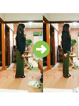 サプライズ整体院/30代ママさんの巻き肩初回結果