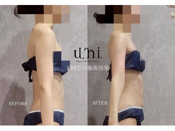 ユニ(uni.)/ブライダル前に大人気