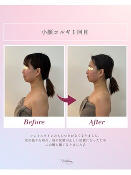 ヴィオルネ(VIE ORNER)/