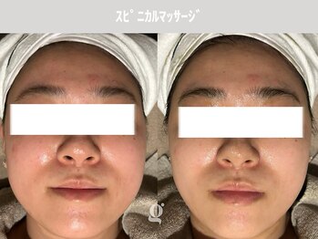 グレイスリリー 表参道(gracelily)/若返る美容液！