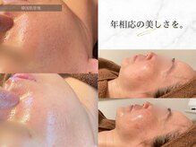 ひっそり美肌構築