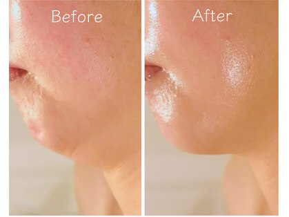 エービューティ(A.beauty)の写真