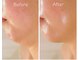 エービューティ(A.beauty)の写真