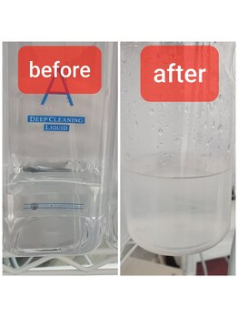 カドル(Cuddle)/ハイドラはお顔の汚れをキレイに