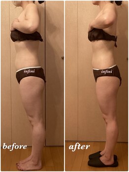 アンフィニ(infini)/全身短期集中コース5回(2ヶ月)