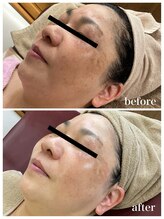 ジャスミン(Jasmin)/エステティック×シェービング