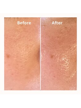 サンクレール(3.ClaiR)/人気のハイドロで透明感アップ