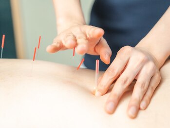 いじり整体院の写真/首肩のコリ,コリによる発達したポッコリ僧帽筋を鍼施術でケアしスッキリ華奢見え！首が長く見える効果も◎