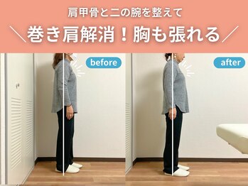 整体院カイト/【巻き肩】