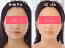 ルミアロマ(RumiAroma)の雰囲気（【初回の変化】お悩み：顔のむくみ/成人式の前撮り前に/小顔に◎）