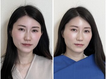 シキサイ 千葉船橋(SIKI-SAI)/トータル診断