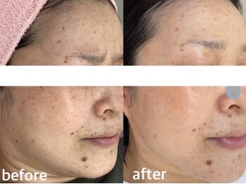 サクラ 伊勢原店(SAKURA)/変われる◎何歳でも変われる◎