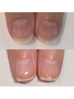 ルクレール カシェット(Le clair cachette)/美爪育成コース