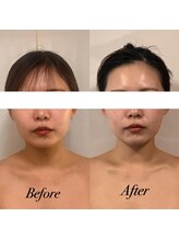 ボディヒーリングアンド小顔美容矯正 プララン/1回目→3回目ビフォーアフター☆