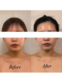 ボディヒーリングアンド小顔美容矯正 プララン/1回目→3回目ビフォーアフター☆