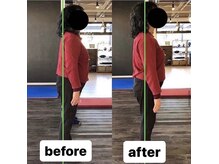 カワル整体 上通り院/なぜ外モモが張る？