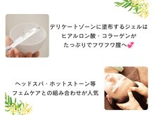 ブーケの雰囲気（黒ずみに効果的なジェルを使用♪他メニューの組み合わせも人気！）