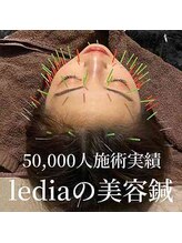 ルディア 堂島店(ledia)/50,000人の美容鍼施術が信頼の証