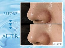 クリアラボ 上野(Clear Lab)/韓国肌管理&毛穴洗浄専門店