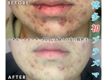 オリオンドットエスツー(Orion.S2)/【Before→After】