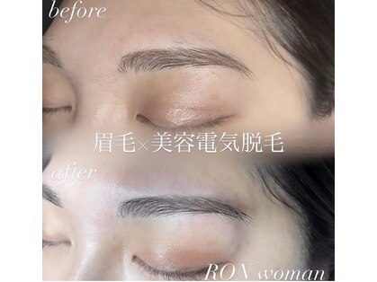 サロンロンウーマン(SALON RON woman)の写真