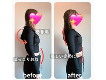 ライトワーク 西新宿店/巻肩矯正