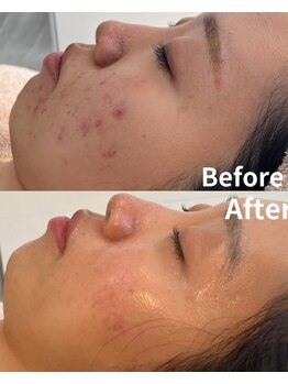 スリリアン 銀座/★お客さまビフォーアフター★