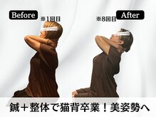 ハリユナイテッド 原宿鍼灸 整体院(HALI UNITED)/鍼＋整体で猫背卒業！美姿勢へ