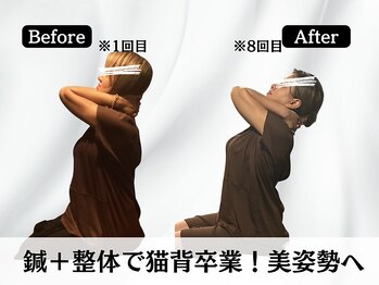 ハリユナイテッド 原宿鍼灸 整体院(HALI UNITED)/鍼+整体で猫背卒業!美姿勢へ