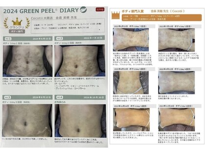 ココティー 大阪店(Cocotii)の写真