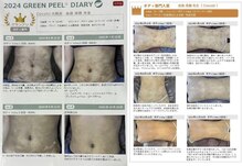 ココティー 大阪店(Cocotii)