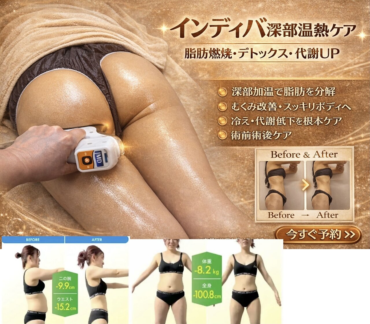 中央区でEMSが人気のエステサロン｜ホットペッパービューティー