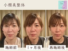 アンドヌーク(&nuuk)の雰囲気(即日効果も◎若々しい印象で効果持続!痛みない小顔施術◇)