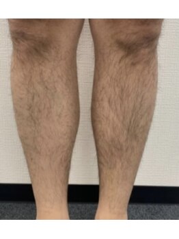 ララ オートクチュール(LALA HAUTOCOUTURE)/