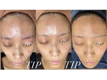 エムエルフ(emuerufu)/