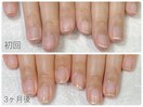 最強のネイルケア(自爪育成)赤羽