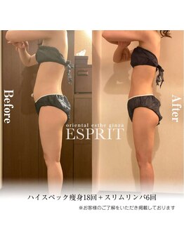 エスプリ 銀座店/痩身エステ銀座・ブライダル