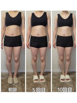 イストアールエム(HISTOIRE.M)/筋膜リリースダイエットコース