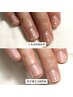 【深爪矯正プログラムの方はこちら】リピーターさま