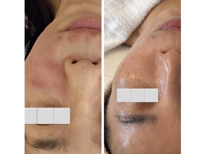 リュミエール(Lumie're)の写真