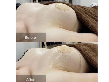 アファン 鶴見店(Afun)/バストアップBeforeAfter