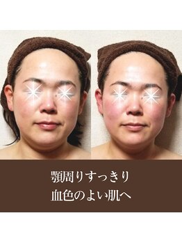 バンブー(bamboo)/アゴまわりすっきり!血色よい肌